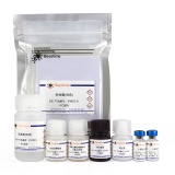 碧云天 Mouse IgE ELISA Kit(小鼠总免疫球蛋白E酶联免疫吸附检测试剂盒)(PI476)