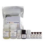 碧云天 Rat IgG ELISA Kit(大鼠总免疫球蛋白G酶联免疫吸附检测试剂盒)(PI482)