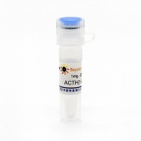 碧云天 ACTH(1-24) human (人促肾上腺皮质激素, 1-24)(P9019-1mg)