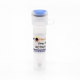 碧云天 ACTH(1-17) human (人促肾上腺皮质激素, 1-17)(P9032-25mg)