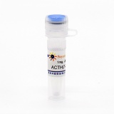 碧云天 ACTH(7-38) human (人促肾上腺皮质激素, 7-38)(P9041-1mg)